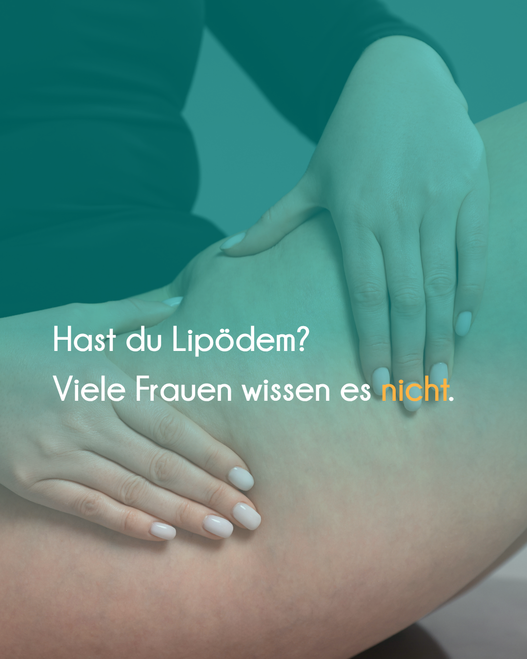 Lipödem Beine